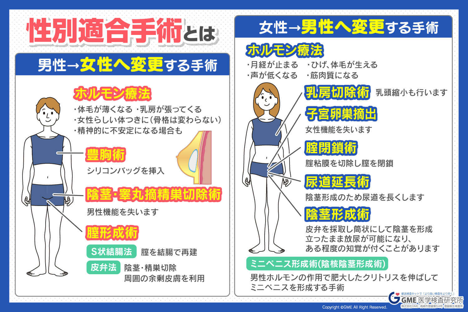 トランスジェンダーの方々の性別適合手術（性転換手術）後の性感染症（STI）検査は? | GME医学検査研究所